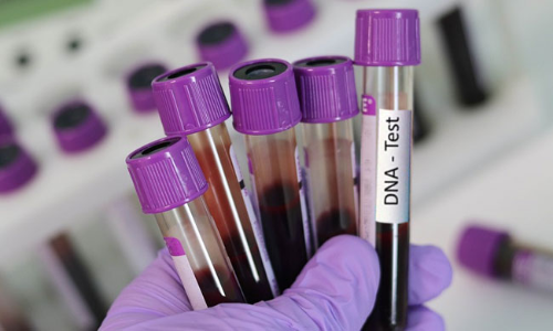 Kerala High Court Allows Mans Plea For DNA Test Of Child To Establish Wifes Infidelity Kerala High Court Allows Mans Plea For DNA Test Of Child To Establish Wifes Infidelity