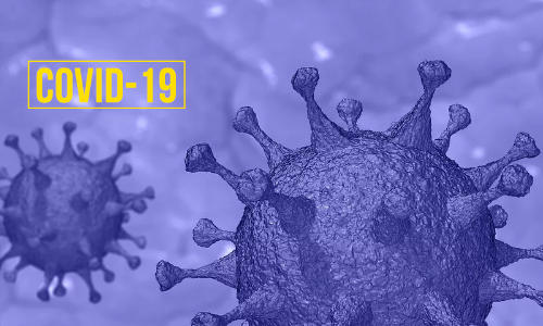 SCAORA Suggests Measures For Restricted Court Functioning Due To COVID19 Pandemic SCAORA Suggests Measures For Restricted Court Functioning Due To COVID19 Pandemic