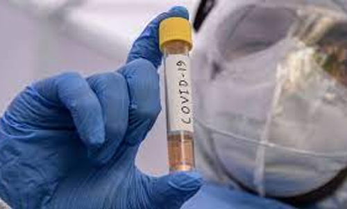Can State Fix RT-PCR Rates For Private Labs? Kerala High Court Refers Issue To Division Bench Can State Fix RT-PCR Rates For Private Labs? Kerala High Court Refers Issue To Division Bench